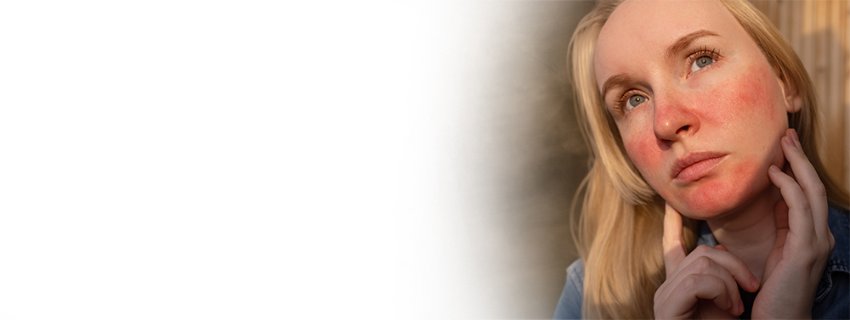 BIOPTRON® HYPERLIGHT THERAPY SYSTEM  Eine neue Lösung zur Linderung von atopischer Dermatitis & Ekzemen